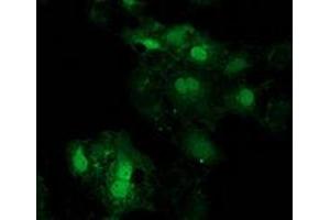 Anti-EIF4E2 mouse monoclonal antibody (ABIN2454229) immunofluorescent staining of COS7 cells transiently transfected by pCMV6-ENTRY EIF4E2 (RC201391). (EIF4E2 Antikörper)