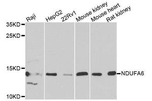 Western blot analysis of extracts of various cell lines, using NDUFA6 antibody. (NDUFA6 Antikörper  (AA 35-154))