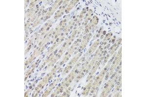 Immunohistochemistry of paraffin-embedded mouse stomach using FANCL antibody at dilution of 1:100 (x40 lens). (FANCL Antikörper)