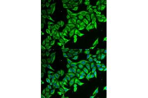 Immunofluorescence analysis of MCF-7 cells using DAP antibody (ABIN6130322, ABIN6139397, ABIN6139398 and ABIN6221757). (DAP Antikörper  (AA 1-102))