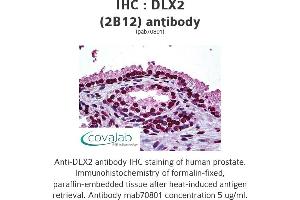 Image no. 1 for anti-Distal-Less Homeobox Protein 2 (DLX2) (AA 1-110) antibody (ABIN1723650) (DLX2 Antikörper  (AA 1-110))