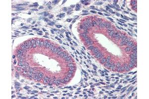 Immunohistochemistry (IHC) image for anti-Grainyhead-Like 2 (GRHL2) (Middle Region) antibody (ABIN2778358) (GRHL2 Antikörper  (Middle Region))