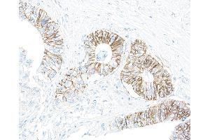 Immunohistochemistry (IHC) image for anti-alpha 1 Sodium Potassium Atpase antibody (ABIN7455086) (alpha 1 Sodium Potassium Atpase Antikörper)