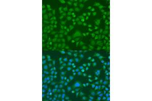 Immunofluorescence analysis of U2OS cells using EWSR1 antibody (ABIN1882293) at dilution of 1:100. (EWSR1 Antikörper)