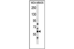 Western blot analysis of PTDSS2 Antibody (N-term) in MDA-MB435 cell line lysates (35ug/lane).