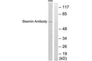 Western blot analysis of extracts from K562 cells, using Desmin Antibody. (Desmin Antikörper  (AA 421-470))