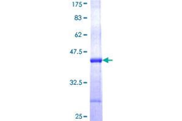 PGGT1B Protein (AA 1-105) (GST tag)