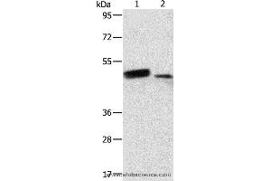 Western blot analysis of Human liver cancer and normal liver tissue, using RARB Polyclonal Antibody at dilution of 1:500 (Retinoic Acid Receptor beta Antikörper)