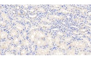 Detection of IL1b in Caprine Kidney Tissue using Polyclonal Antibody to Interleukin 1 Beta (IL1b) (IL-1 beta Antikörper  (AA 1-266))