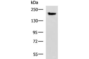 Western blot analysis of Mouse brain tissue lysate using PDS5B Polyclonal Antibody at dilution of 1:800 (PDS5B Antikörper)