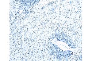 Immunohistochemistry (IHC) image for anti-Ionized Calcium-binding Adapter Molecule 1 (IBA1) (C-Term) antibody (ABIN184738)