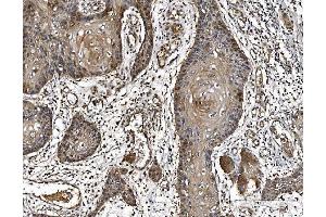 IHC analysis of PARK7/DJ1 using anti-PARK7/DJ1 antibody (ABIN7600468). (PARK7/DJ1 Antikörper  (AA 2-189))