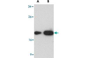 Western blot analysis of (A) 25 and (B) 125 ng of LY96 recombinant protein with LY96 monoclonal antibody, clone 1A2E3  at 1 ug/mL . (LY96 Antikörper  (AA 2-160))