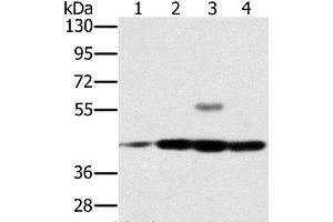 Western Blot analysis of Jurkat, Raji, K562 and hela cell using PAICS Polyclonal Antibody at dilution of 1:400