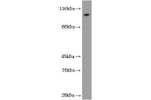 Image no. 1 for anti-Luteinizing Hormone/Choriogonadotropin Receptor (LHCGR) antibody (ABIN2937954) (LHCGR Antikörper)