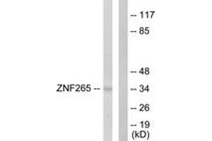 Western blot analysis of extracts from HeLa cells, using ZNF265 Antibody. (ZNF265 Antikörper  (AA 106-155))