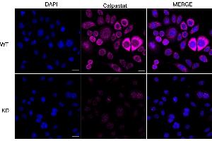 anti-Calpastatin (CAST) antibody