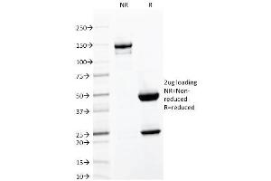 SDS-PAGE Analysis Purified CD103 Mouse Monoclonal Antibody (ITGAE/2063). (CD103 Antikörper)