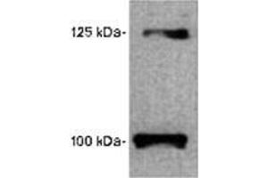 Image no. 1 for anti-Leptin Receptor (LEPR) (AA 577-594) antibody (ABIN187816) (Leptin Receptor Antikörper  (AA 577-594))