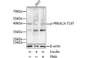 Western blot analysis of extracts of 293T cells, using Phospho-PKA C-alpha (PRKACA)-T197 antibody (ABIN6135290, ABIN6136202, ABIN6136203 and ABIN6225582) at 1:1000 dilution.