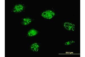 Immunofluorescence of monoclonal antibody to SMARCD3 on HeLa cell. (SMARCD3 Antikörper  (AA 385-483))