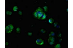 Immunofluorescent analysis of MCF-7 cells using ABIN7147251 at dilution of 1:100 and Alexa Fluor 488-congugated AffiniPure Goat Anti-Rabbit IgG(H+L) (CDON Antikörper  (AA 1095-1211))