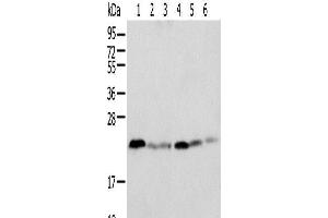 Western blot analysis of K-562 cell Human placenta tissue Mouse adrenal gland tissue HT-29 cell NIH/3T3 cell Rat lung tissue using SPCS2 Polyclonal Antibody at dilution of 1:500 (SPCS2 Antikörper)