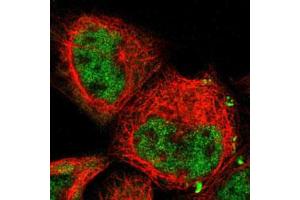 Immunofluorescent staining of A-431 cells with COPS5 polyclonal antibody  (Green) shows positivity in nucleus but excluded from the nucleoli. (COPS5 Antikörper)