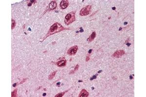 Ubiquilin 1 antibody was used for immunohistochemistry at a concentration of 4-8 ug/ml. (Ubiquilin 1 Antikörper  (Middle Region))