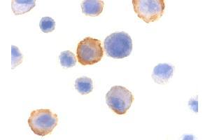 Immunocytochemistry of BMF in HeLa cells with BMF polyclonal antibody  at 10 ug/mL . (BMF Antikörper  (N-Term))