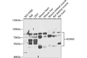 Western blot analysis of extracts of various cell lines, using KCNN3 antibody (ABIN6131839, ABIN6142768, ABIN6142770 and ABIN6218217) at 1:1000 dilution. (KCNN3 Antikörper  (AA 237-426))