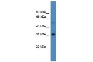 WB Suggested Anti-LBX1 Antibody Titration:  0.