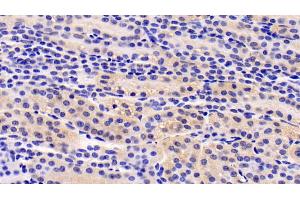 Detection of IGF1 in Human Kidney Tissue using Monoclonal Antibody to Insulin Like Growth Factor 1 (IGF1) (IGF1 Antikörper  (AA 49-118))