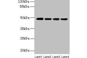 Western blot All lanes: INHBA antibody at 2 μg/mL Lane 1: Hela whole cell lysate Lane 2: HepG2 whole cell lysate Lane 3: A549 whole cell lysate Lane 4: MCF-7 whole cell lysate Secondary Goat polyclonal to rabbit IgG at 1/10000 dilution Predicted band size: 48 kDa Observed band size: 48 kDa (INHBA Antikörper  (AA 311-426))