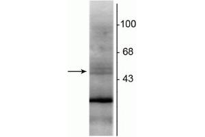 Western blot of rat hippocampal lysate showing specific immunolabeling of the ~48 kDa RXR-β protein.