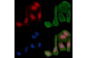 ABIN6255665 and ABIN6268972 staining Hela cells(30 min of UV treatment) by IF/ICC. (Cyclin H Antikörper  (pThr315))