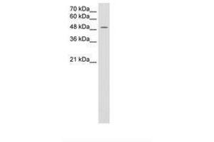 Image no. 2 for anti-Monocarboxylate Transporter 3 (MCT3) (AA 251-300) antibody (ABIN205015) (MCT3 Antikörper  (AA 251-300))