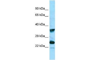 WB Suggested Anti-MRGPRX4 Antibody Titration: 1.