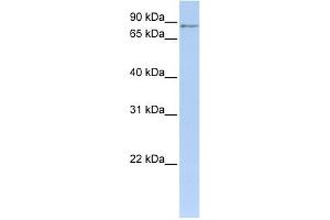 MTO1 antibody used at 1 ug/ml to detect target protein. (MTO1 Antikörper)