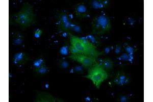 Anti-DYNC1LI1 mouse monoclonal antibody (ABIN2452970) immunofluorescent staining of COS7 cells transiently transfected by pCMV6-ENTRY DYNC1LI1 (RC222010). (DYNC1LI1 Antikörper)