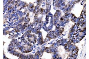 IHC analysis of p57 Kip2/CDKN1C using anti-p57 Kip2/CDKN1C antibody (ABIN7603232).