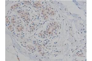 ABIN6267359 at 1/200 staining Human heart tissue sections by IHC-P. (MAPT Antikörper  (pThr231))