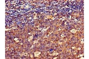 Immunohistochemistry of paraffin-embedded human tonsil tissue using ABIN7148581 at dilution of 1:100 (SPRR1A Antikörper  (AA 8-72))