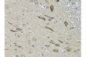 Immunohistochemistry (IHC) image for anti-Adrenergic, Beta, Receptor Kinase 2 (ADRBK2) (AA 1-300) antibody (ABIN3022787)