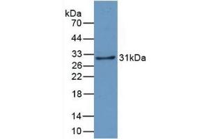 Detection of Recombinant CRYl1, Human using Monoclonal Antibody to Crystallin Lambda 1 (CRYl1) (CRYL1 Antikörper  (AA 24-232))