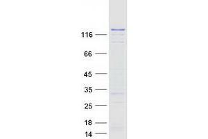 DNMT3A Protein (Transcript Variant 3) (Myc-DYKDDDDK Tag)
