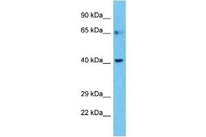 Host:  Rabbit  Target Name:  BTBD6  Sample Type:  Stomach Tumor lysates  Antibody Dilution:  1. (BTBD6 Antikörper  (C-Term))