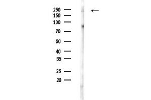 Western blot analysis of lysates from Rat testis, using Phospho-BRG1 (Ser721) Antibody at 1/1000 dilution.