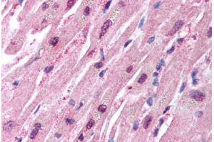 Human Heart (formalin-fixed, paraffin-embedded) stained with HUWE1 antibody ABIN213933 at 5 ug/ml followed by biotinylated goat anti-rabbit IgG secondary antibody ABIN481713, alkaline phosphatase-streptavidin and chromogen. (HUWE1 Antikörper  (C-Term))