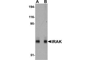 Western Blotting (WB) image for anti-Interleukin-1 Receptor-Associated Kinase 1 (IRAK1) (AA 618-712) antibody (ABIN492548) (IRAK1 Antikörper  (AA 618-712))